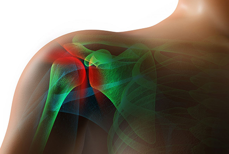 Frozen Shoulder Treatment